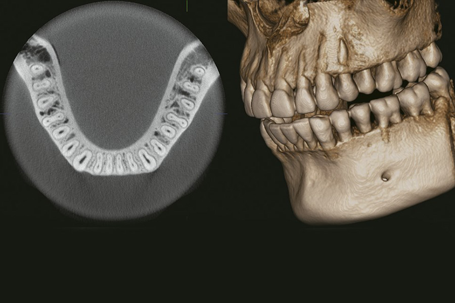 Operador Dental - Dentadura