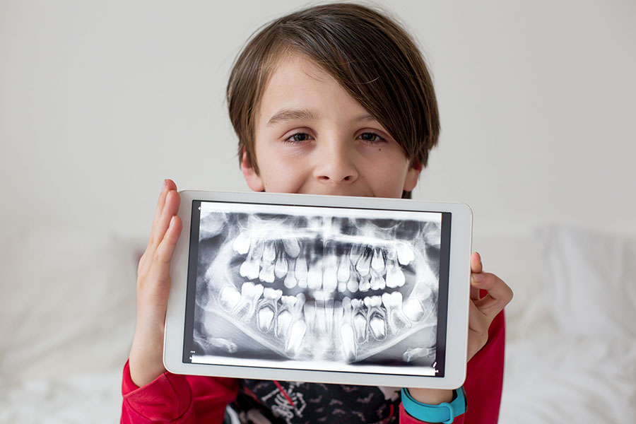 Foto dientes adolescente con rayos x